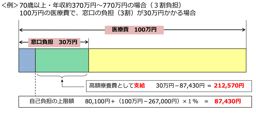 日本とアメリカの市場の違い